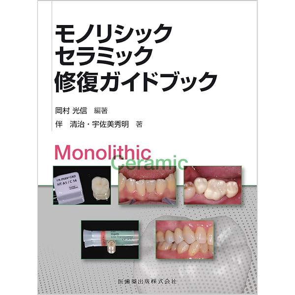 歯界展望別冊 モノリシックジルコニアレストレーション [雑誌